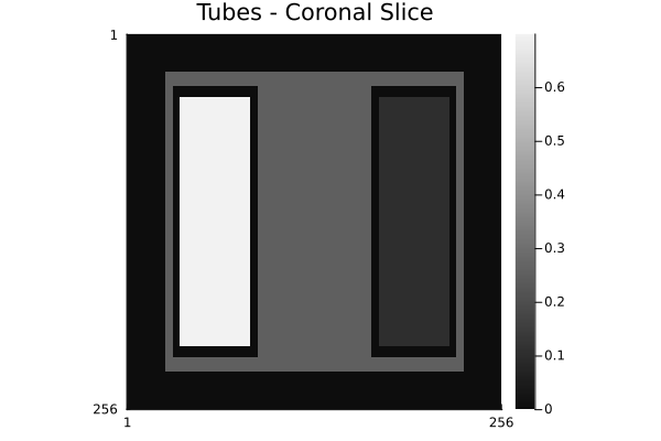 tubes_coronal.png