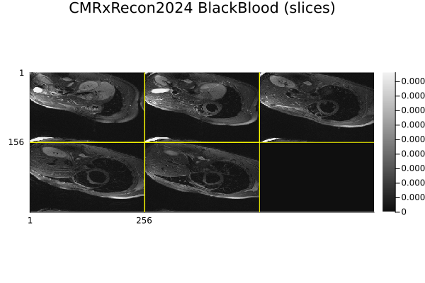 CMRxRecon2024 BlackBlood