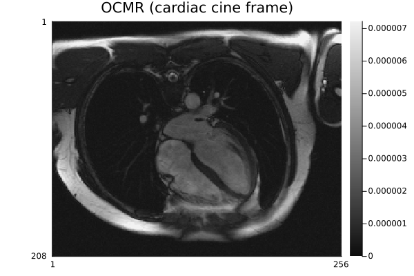 OCMR cardiac cine