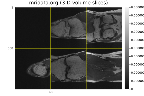 mridata.org 3-D volume